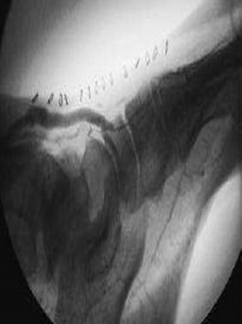 La chirurgia di rivascolarizzazione delle arterie tibiali. Corso teorico-pratico 25 novembre 2011