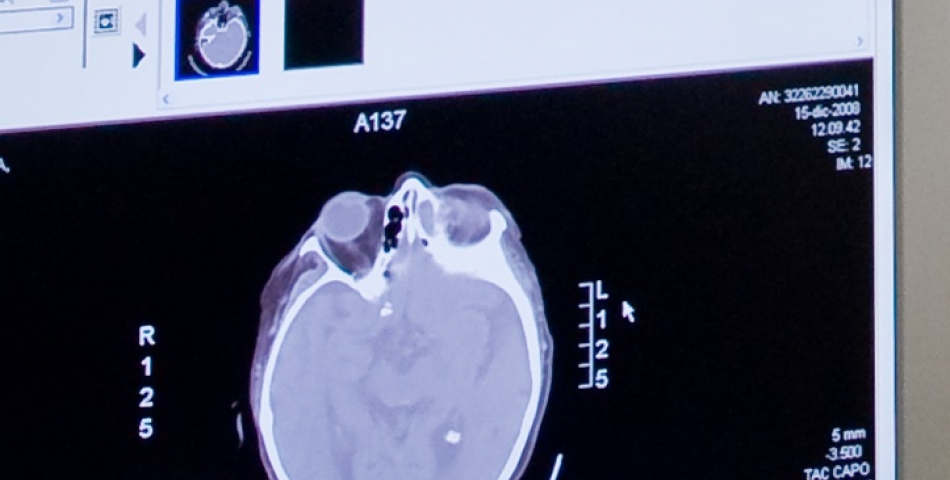 neurochirurgia poliambulanza brescia