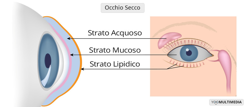 Occhio secco Poliambulanza