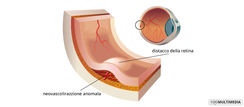 Retinografia Poliambulanza