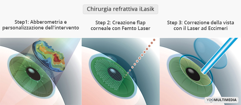 Chirurgia Refrattiva iLasik poliambulanza