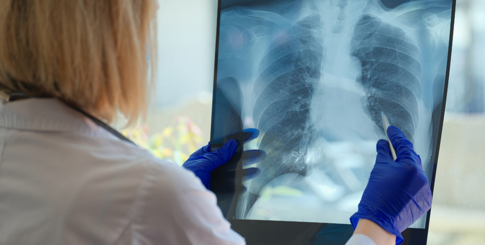 Ambulatorio ipertensione polmonare 