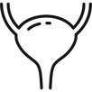 Tumore della vescica